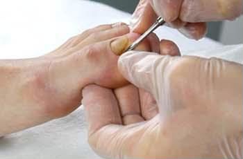 Выполню - педикюр - обработка проблемных ногтей