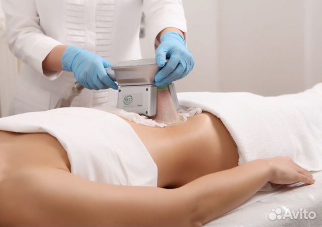 Модель на криолиполиз Coolsculpting